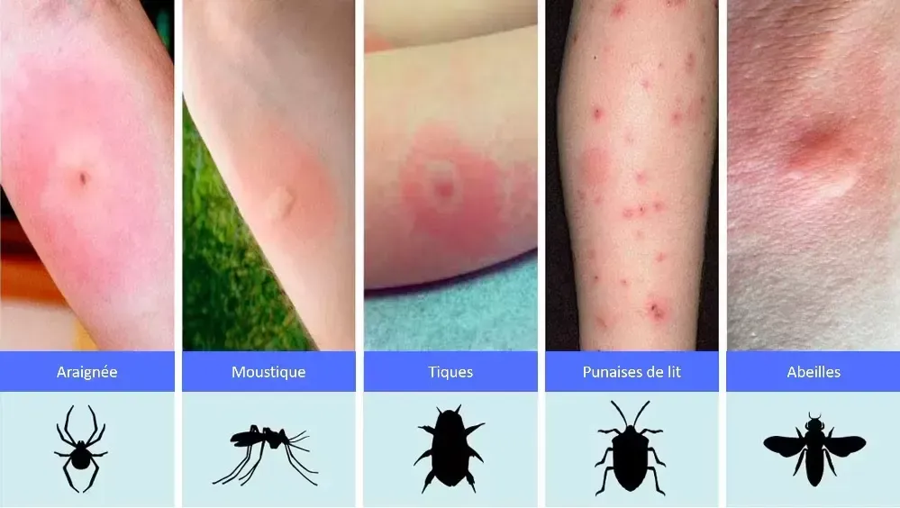 punaise de lit (5)